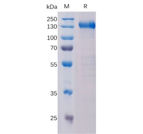 SDS-PAGE - Recombinant Human CCK4 Protein (Fc Tag) (A318330) - Antibodies.com