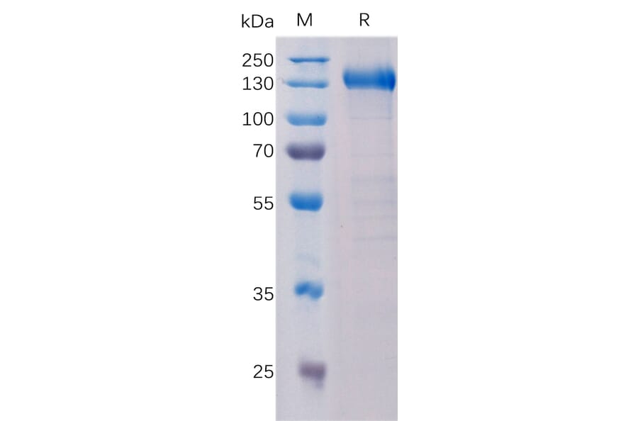 SDS-PAGE - Recombinant Human CCK4 Protein (Fc Tag) (A318330) - Antibodies.com