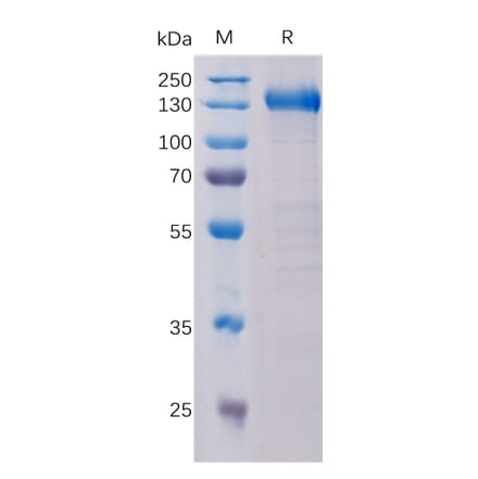 SDS-PAGE - Recombinant Human CCK4 Protein (Fc Tag) (A318330) - Antibodies.com