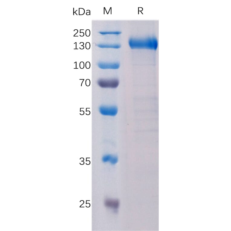 SDS-PAGE - Recombinant Human CCK4 Protein (Fc Tag) (A318330) - Antibodies.com