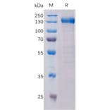 SDS-PAGE - Recombinant Human CCK4 Protein (Fc Tag) (A318330) - Antibodies.com