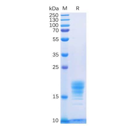SDS-PAGE - Recombinant Human IL-5 Protein (6×His Tag) (A318331) - Antibodies.com
