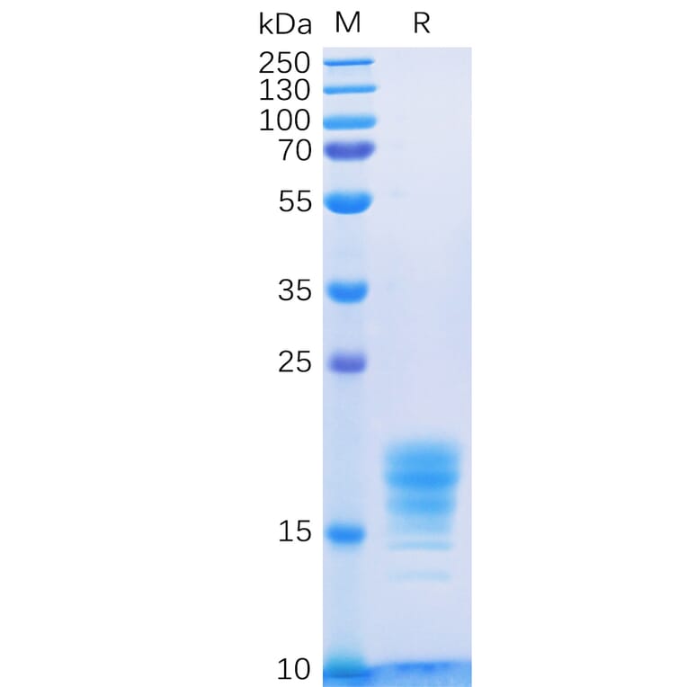 SDS-PAGE - Recombinant Human IL-5 Protein (6×His Tag) (A318331) - Antibodies.com