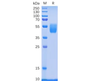 SDS-PAGE - Recombinant Human PSCA Protein (Fc Tag) (A318332) - Antibodies.com