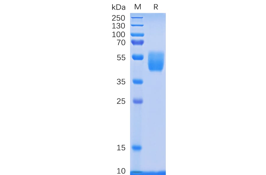 SDS-PAGE - Recombinant Human PSCA Protein (Fc Tag) (A318332) - Antibodies.com
