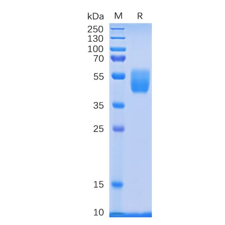 SDS-PAGE - Recombinant Human PSCA Protein (Fc Tag) (A318332) - Antibodies.com