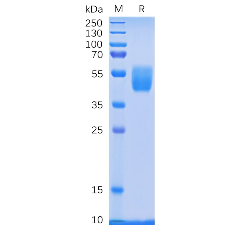 SDS-PAGE - Recombinant Human PSCA Protein (Fc Tag) (A318332) - Antibodies.com