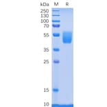 SDS-PAGE - Recombinant Human PSCA Protein (Fc Tag) (A318332) - Antibodies.com