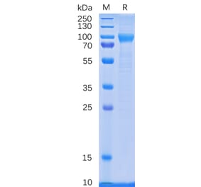 SDS-PAGE - Recombinant Human GCSF Receptor Protein (6×His Tag) (A318333) - Antibodies.com