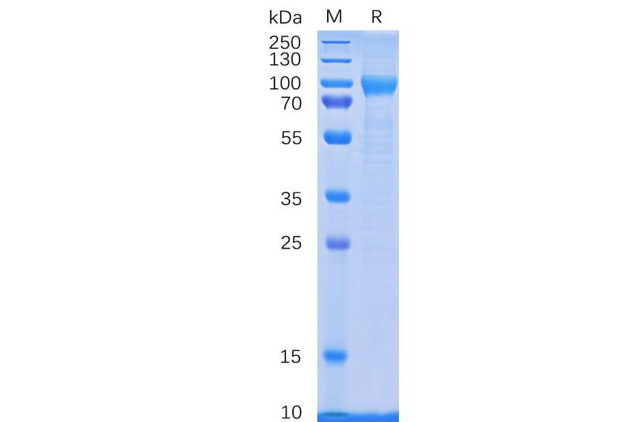SDS-PAGE - Recombinant Human GCSF Receptor Protein (6×His Tag) (A318333) - Antibodies.com