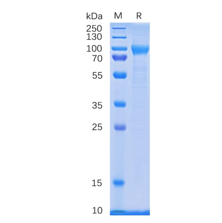 SDS-PAGE - Recombinant Human GCSF Receptor Protein (6×His Tag) (A318333) - Antibodies.com