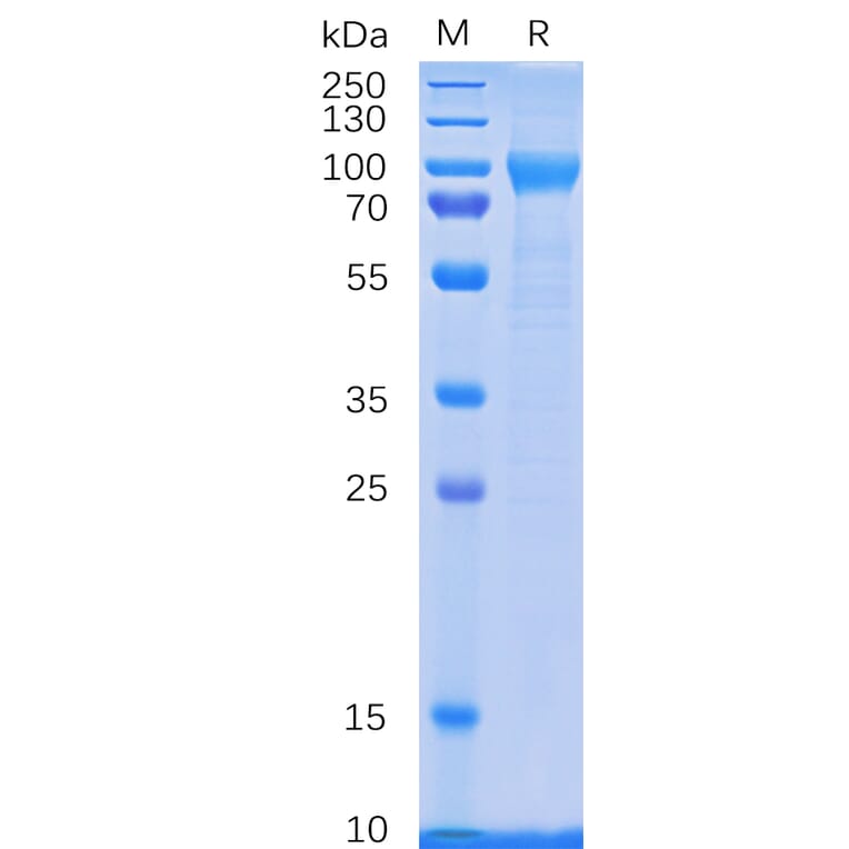 SDS-PAGE - Recombinant Human GCSF Receptor Protein (6×His Tag) (A318333) - Antibodies.com