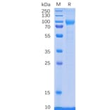 SDS-PAGE - Recombinant Human GCSF Receptor Protein (6×His Tag) (A318333) - Antibodies.com