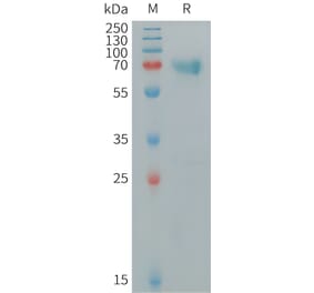 SDS-PAGE - Recombinant Human TNF Receptor II Protein (Fc Tag) (A318334) - Antibodies.com