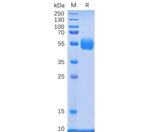 SDS-PAGE - Recombinant Human NKp30 Protein (Fc Tag) (A318335) - Antibodies.com