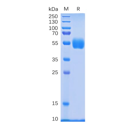 SDS-PAGE - Recombinant Human NKp30 Protein (Fc Tag) (A318335) - Antibodies.com