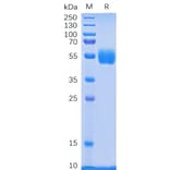 SDS-PAGE - Recombinant Human NKp30 Protein (Fc Tag) (A318335) - Antibodies.com