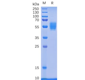 SDS-PAGE - Recombinant Human NKG2D Protein (Fc Tag) (A318336) - Antibodies.com