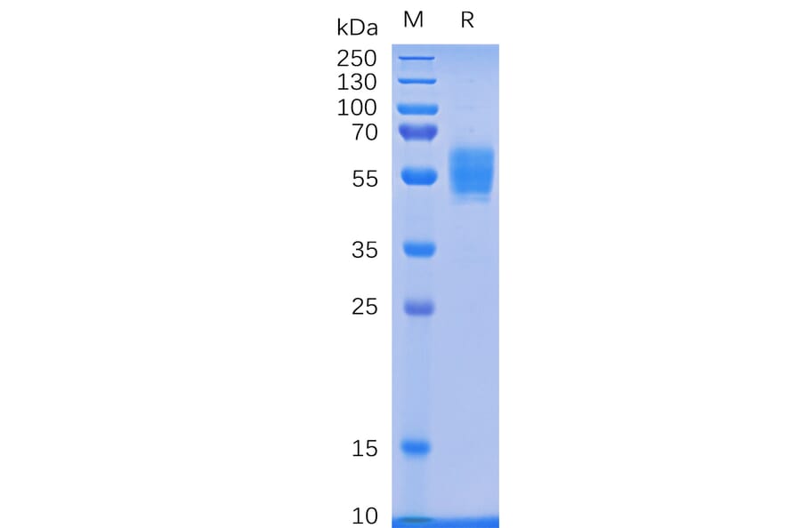 SDS-PAGE - Recombinant Human NKG2D Protein (Fc Tag) (A318336) - Antibodies.com