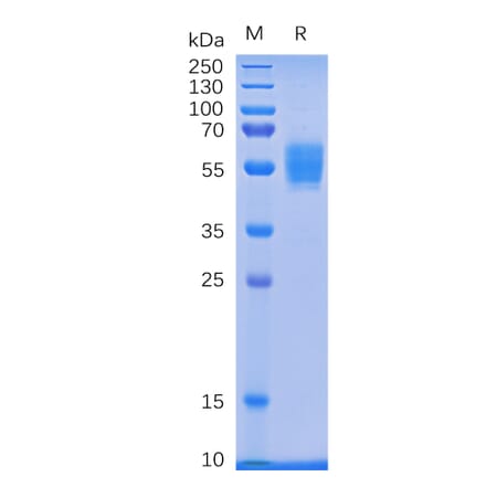 SDS-PAGE - Recombinant Human NKG2D Protein (Fc Tag) (A318336) - Antibodies.com