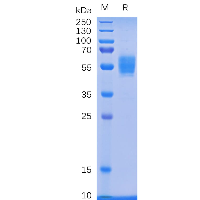 SDS-PAGE - Recombinant Human NKG2D Protein (Fc Tag) (A318336) - Antibodies.com