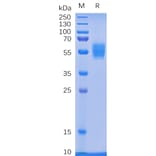 SDS-PAGE - Recombinant Human NKG2D Protein (Fc Tag) (A318336) - Antibodies.com