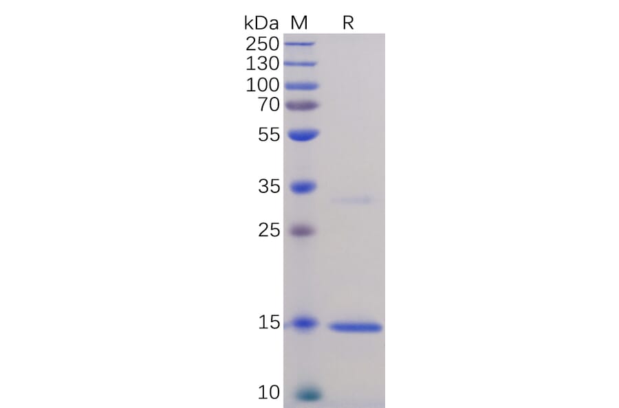 SDS-PAGE - Recombinant Human TNF alpha Protein (6×His Tag) (A318337) - Antibodies.com