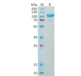 SDS-PAGE - Recombinant Human alpha 1 Fetoprotein Protein (Fc Tag) (A318338) - Antibodies.com