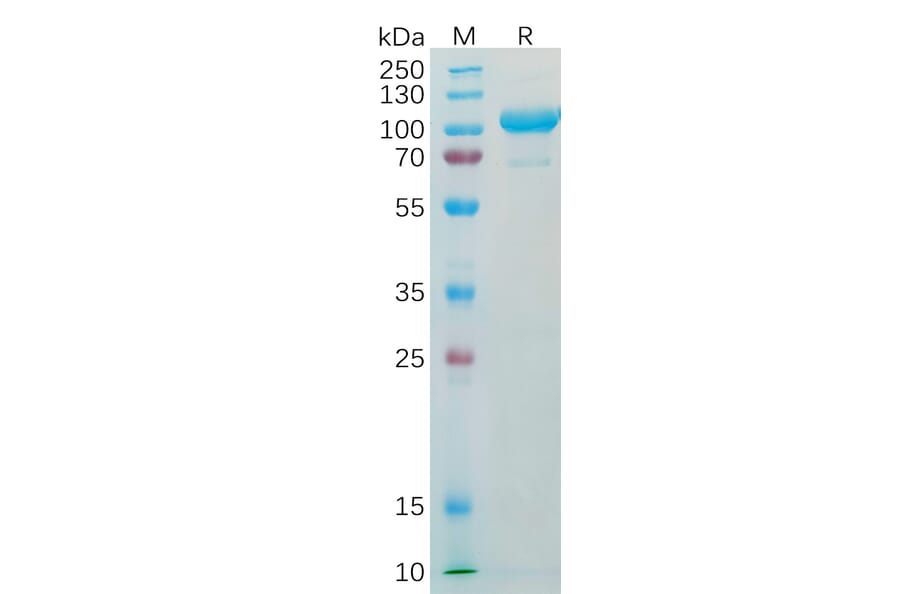 SDS-PAGE - Recombinant Human alpha 1 Fetoprotein Protein (Fc Tag) (A318338) - Antibodies.com