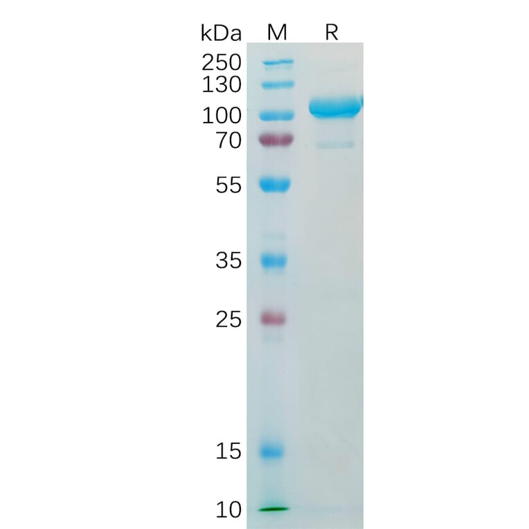 SDS-PAGE - Recombinant Human alpha 1 Fetoprotein Protein (Fc Tag) (A318338) - Antibodies.com