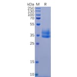 SDS-PAGE - Recombinant Human IL-2 Receptor beta/p75 Protein (6×His Tag) (A318339) - Antibodies.com