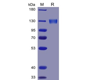 SDS-PAGE - Recombinant Human ACE2 Protein (Fc Tag) (A318341) - Antibodies.com