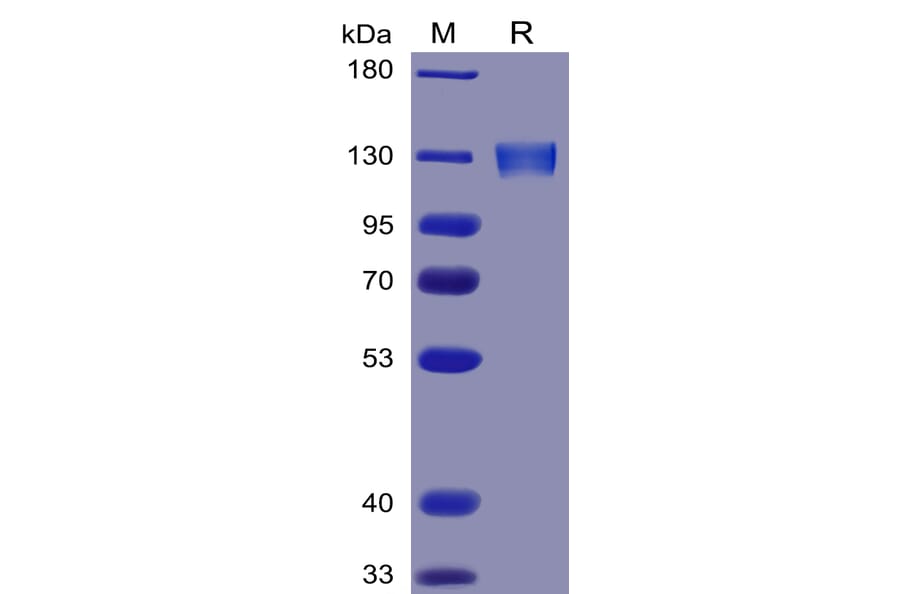 SDS-PAGE - Recombinant Human ACE2 Protein (Fc Tag) (A318341) - Antibodies.com