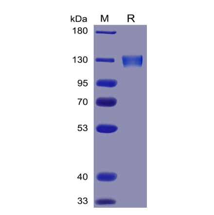 SDS-PAGE - Recombinant Human ACE2 Protein (Fc Tag) (A318341) - Antibodies.com