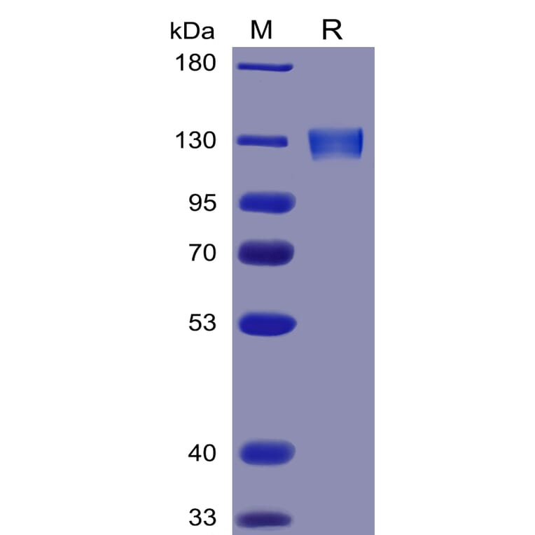 SDS-PAGE - Recombinant Human ACE2 Protein (Fc Tag) (A318341) - Antibodies.com