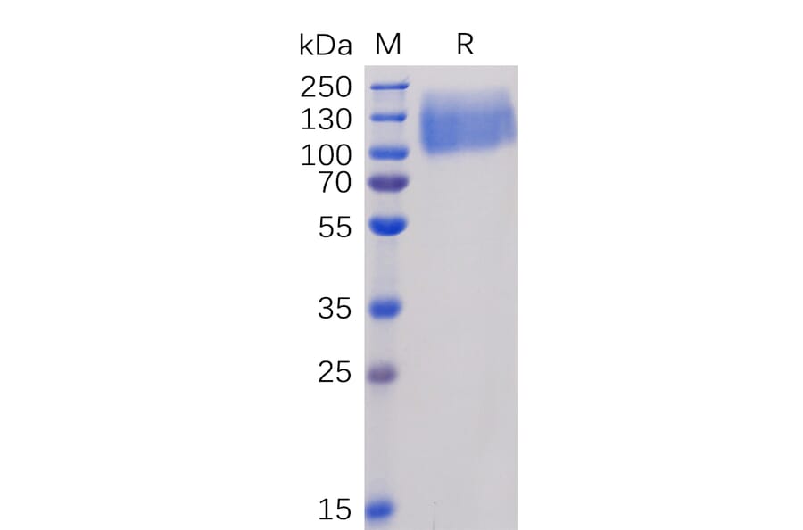 SDS-PAGE - Recombinant Human CEACAM5 Protein (6×His Tag) (A318342) - Antibodies.com