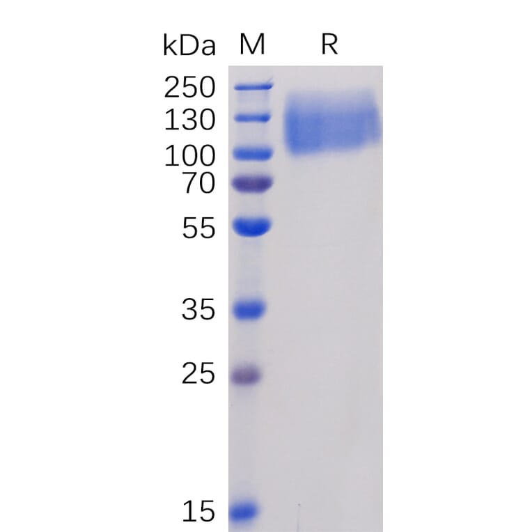 SDS-PAGE - Recombinant Human CEACAM5 Protein (6×His Tag) (A318342) - Antibodies.com