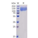 SDS-PAGE - Recombinant Human CEACAM5 Protein (6×His Tag) (A318342) - Antibodies.com