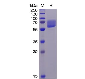 SDS-PAGE - Recombinant Human Axl Protein (6×His Tag) (A318343) - Antibodies.com