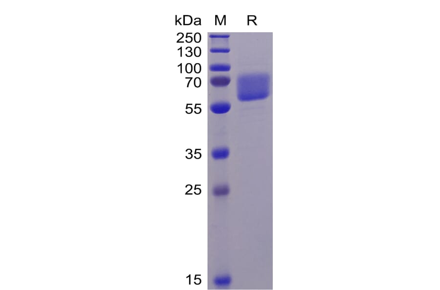 SDS-PAGE - Recombinant Human Axl Protein (6×His Tag) (A318343) - Antibodies.com