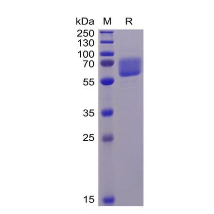 SDS-PAGE - Recombinant Human Axl Protein (6×His Tag) (A318343) - Antibodies.com