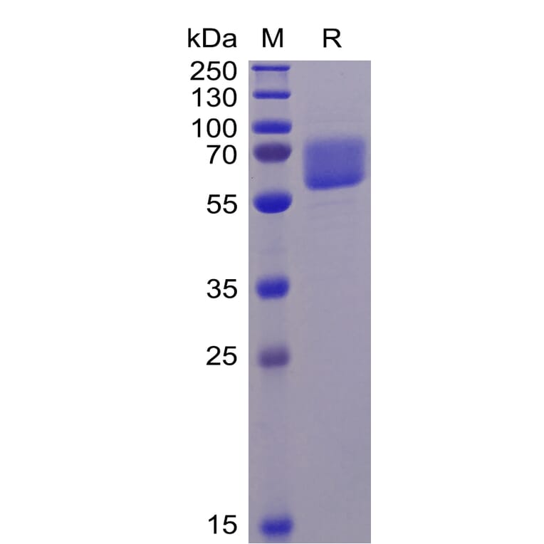 SDS-PAGE - Recombinant Human Axl Protein (6×His Tag) (A318343) - Antibodies.com