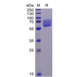 SDS-PAGE - Recombinant Human Axl Protein (6×His Tag) (A318343) - Antibodies.com