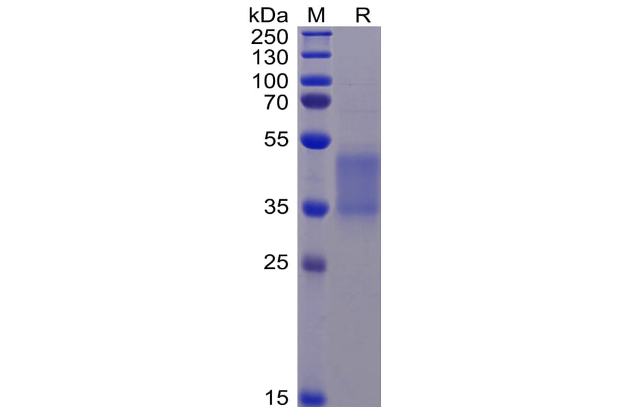 SDS-PAGE - Recombinant Human CD16 Protein (mutated F176V) (6×His Tag) (A318344) - Antibodies.com