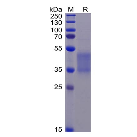 SDS-PAGE - Recombinant Human CD16 Protein (mutated F176V) (6×His Tag) (A318344) - Antibodies.com