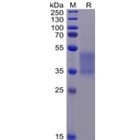SDS-PAGE - Recombinant Human CD16 Protein (mutated F176V) (6×His Tag) (A318344) - Antibodies.com