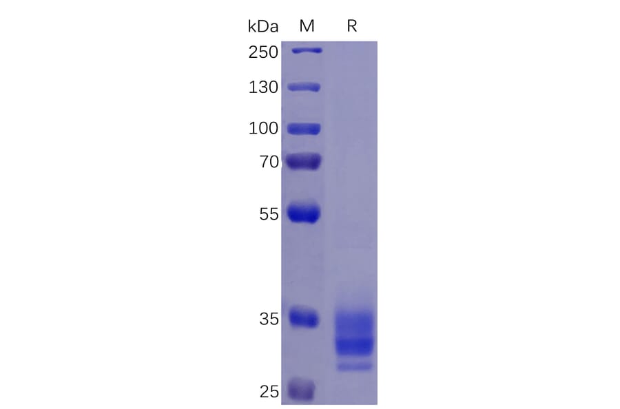 SDS-PAGE - Recombinant Human EpCAM Protein (6×His Tag) (A318345) - Antibodies.com