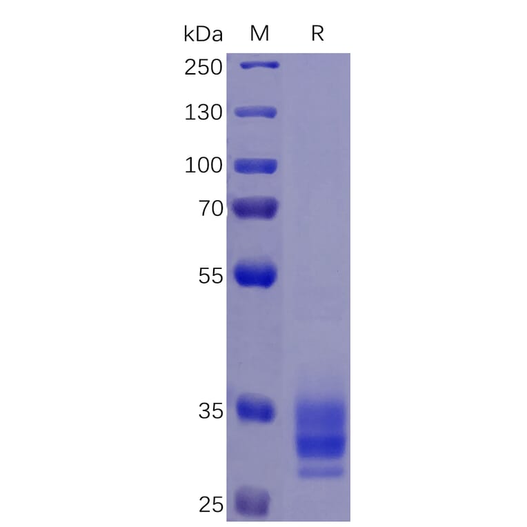SDS-PAGE - Recombinant Human EpCAM Protein (6×His Tag) (A318345) - Antibodies.com
