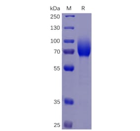 SDS-PAGE - Recombinant Human CSF-1-R Protein (6×His Tag) (A318346) - Antibodies.com