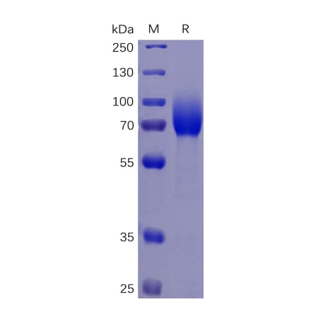 SDS-PAGE - Recombinant Human CSF-1-R Protein (6×His Tag) (A318346) - Antibodies.com